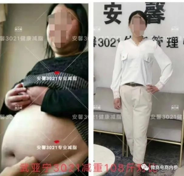 号称减肥不反弹的“安馨3021”果真名副其实？投诉、质疑之声已然存在