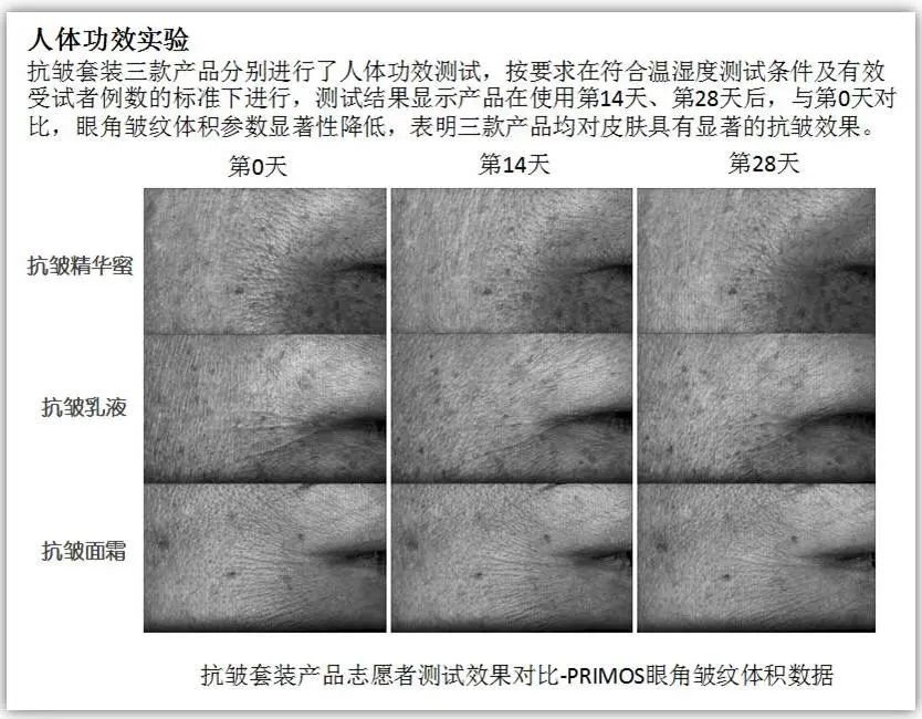 康婷集团护肤新品“抗皱套装”即将震撼上市！