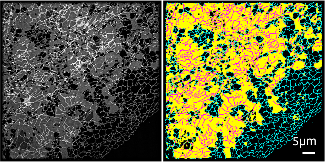 左图：结构光照明成像显示内质网的结构；右图：ERnet分析图像后标记处不同部分的内质网结构，青色-管状内质网，黄色-片状内质网，紫色-片上管状内质网